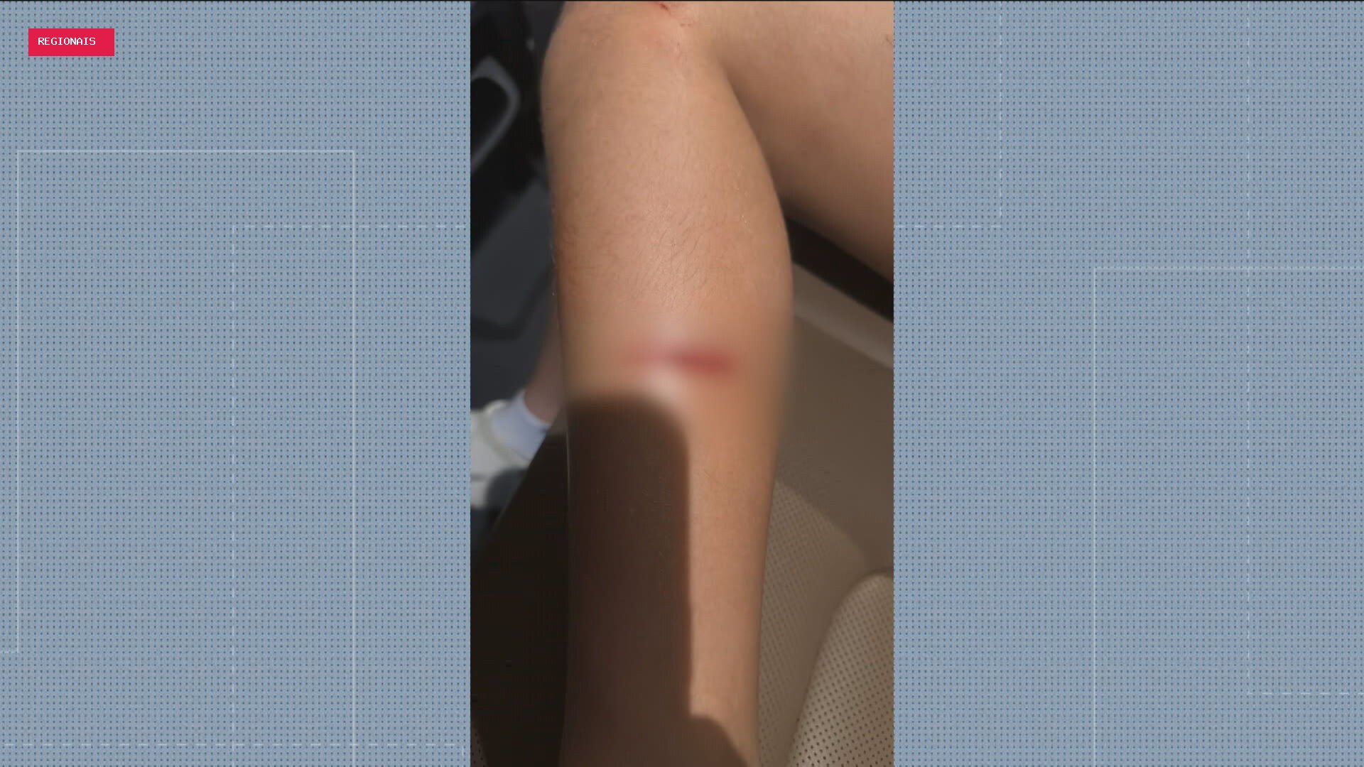 Menina de 11 anos é atropelada por moto na calçada ao sair de aula de dança no Grajaú, Zona Norte do Rio