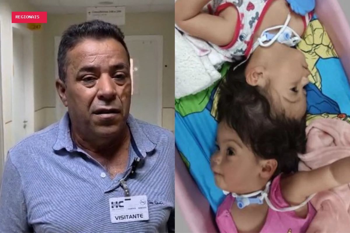 "Isso não se torna derrota", diz pai de siamesas mortas após separação