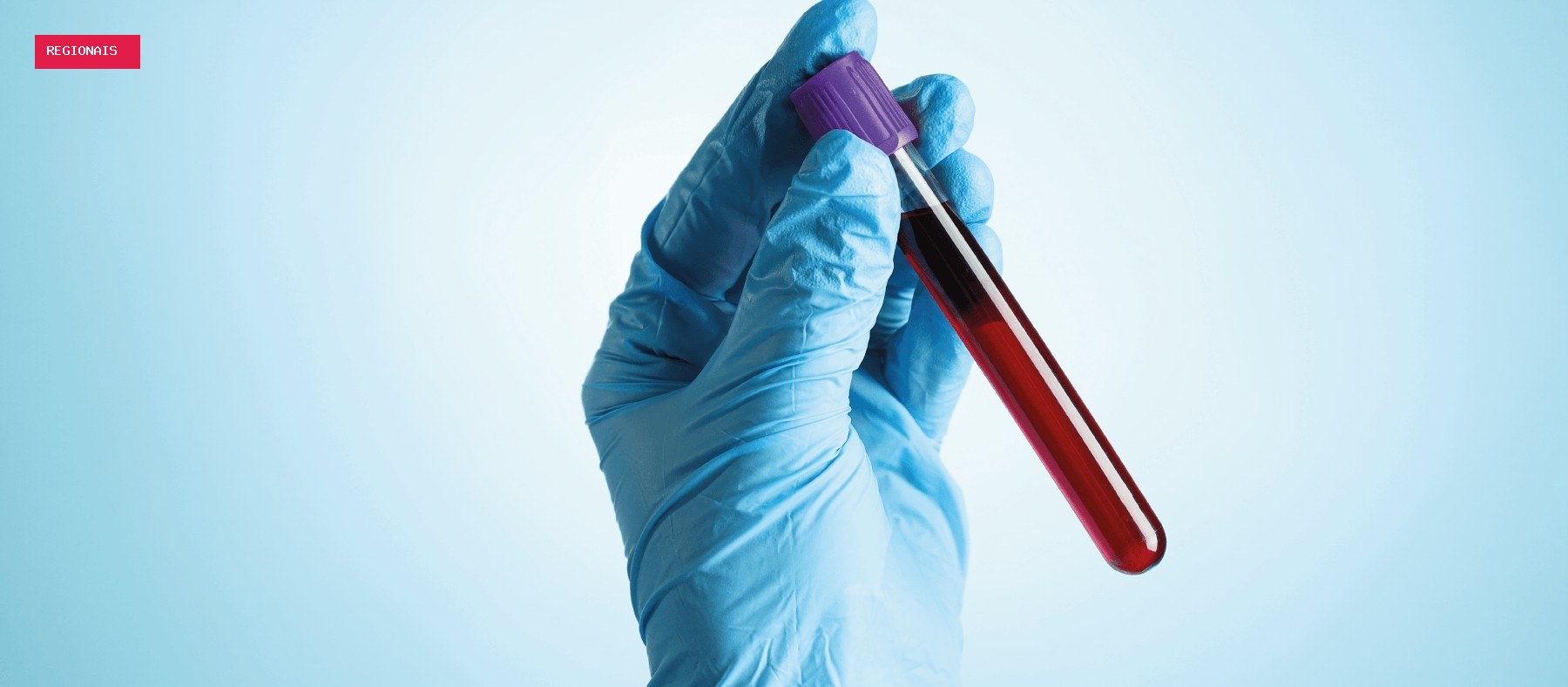 Exame de sangue auxilia na investigação precoce do Alzheimer