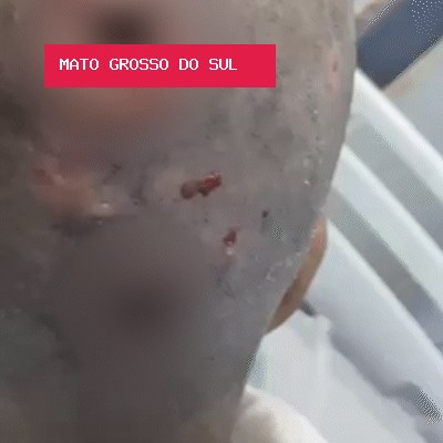 Mulher é resgatada com larvas na cabeça e polícia apura violência sexual