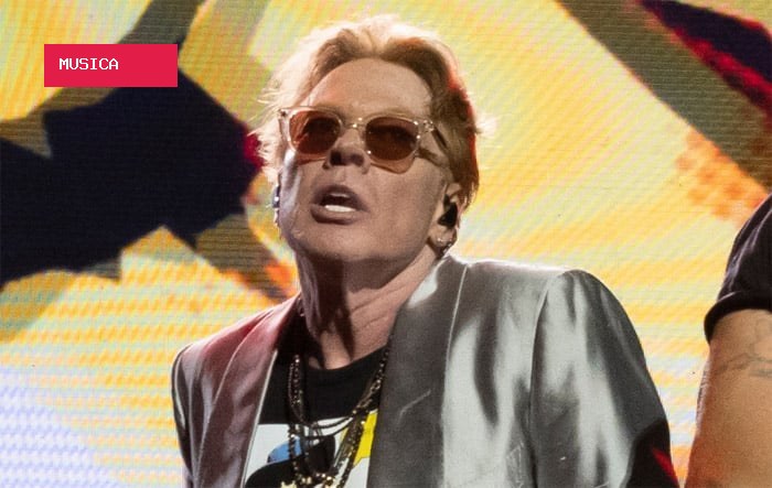 Axl Rose revela problema de saúde que tornou show do Guns N' Roses um desafio
