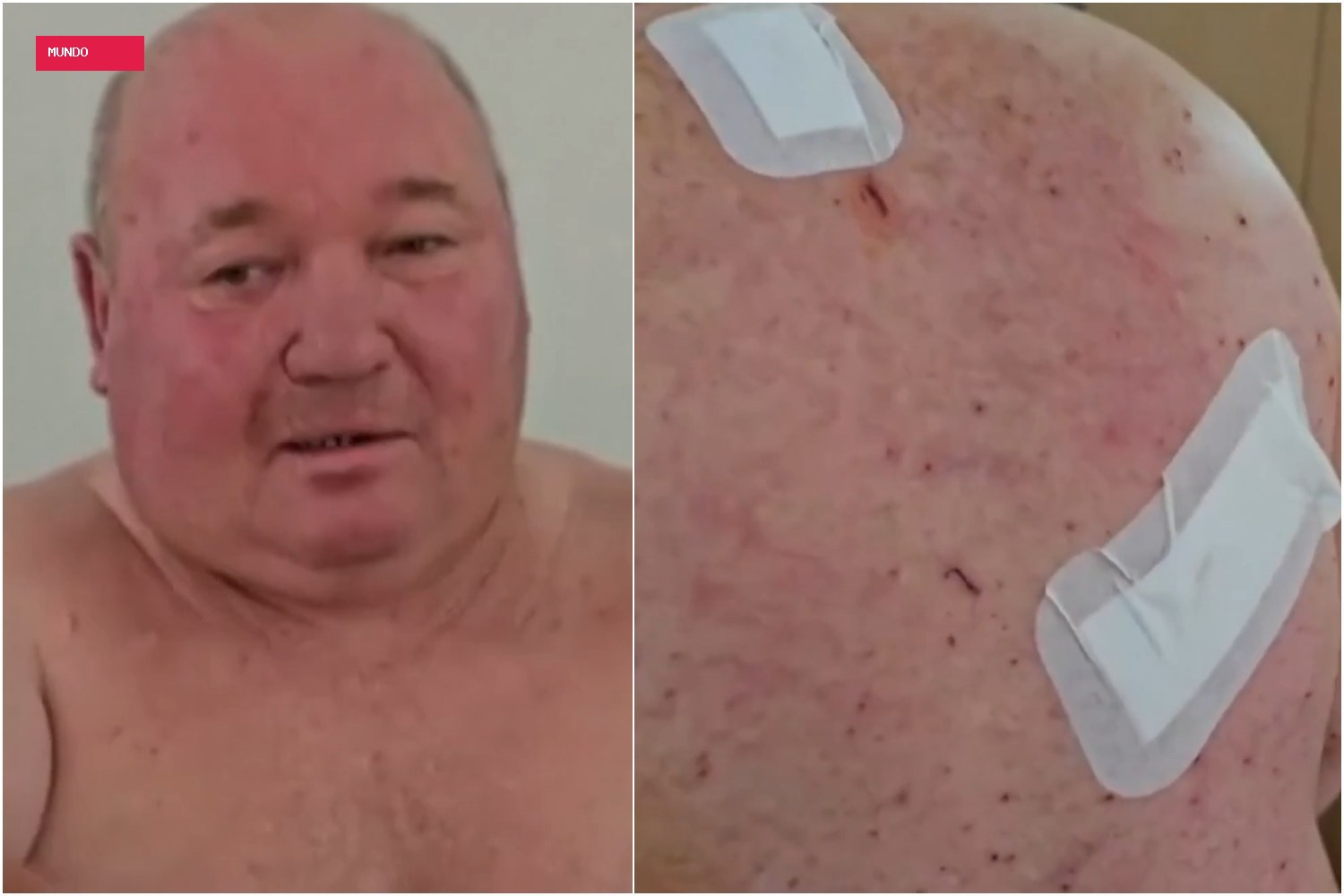 Ucraniano 'perseguido' por drone relata fuga: 'Tentei mostrar que estava só vendendo vegetais'; veja VÍDEO
