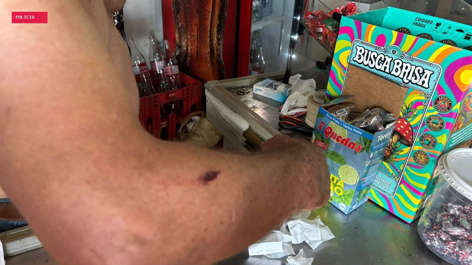 "Não era minha hora", diz comerciante baleado de raspão em atentado com 16 tiros