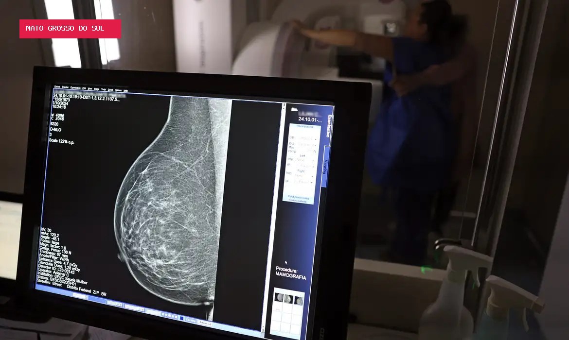 Planos de saúde terão de cobrir mamografia digital para todas as idades