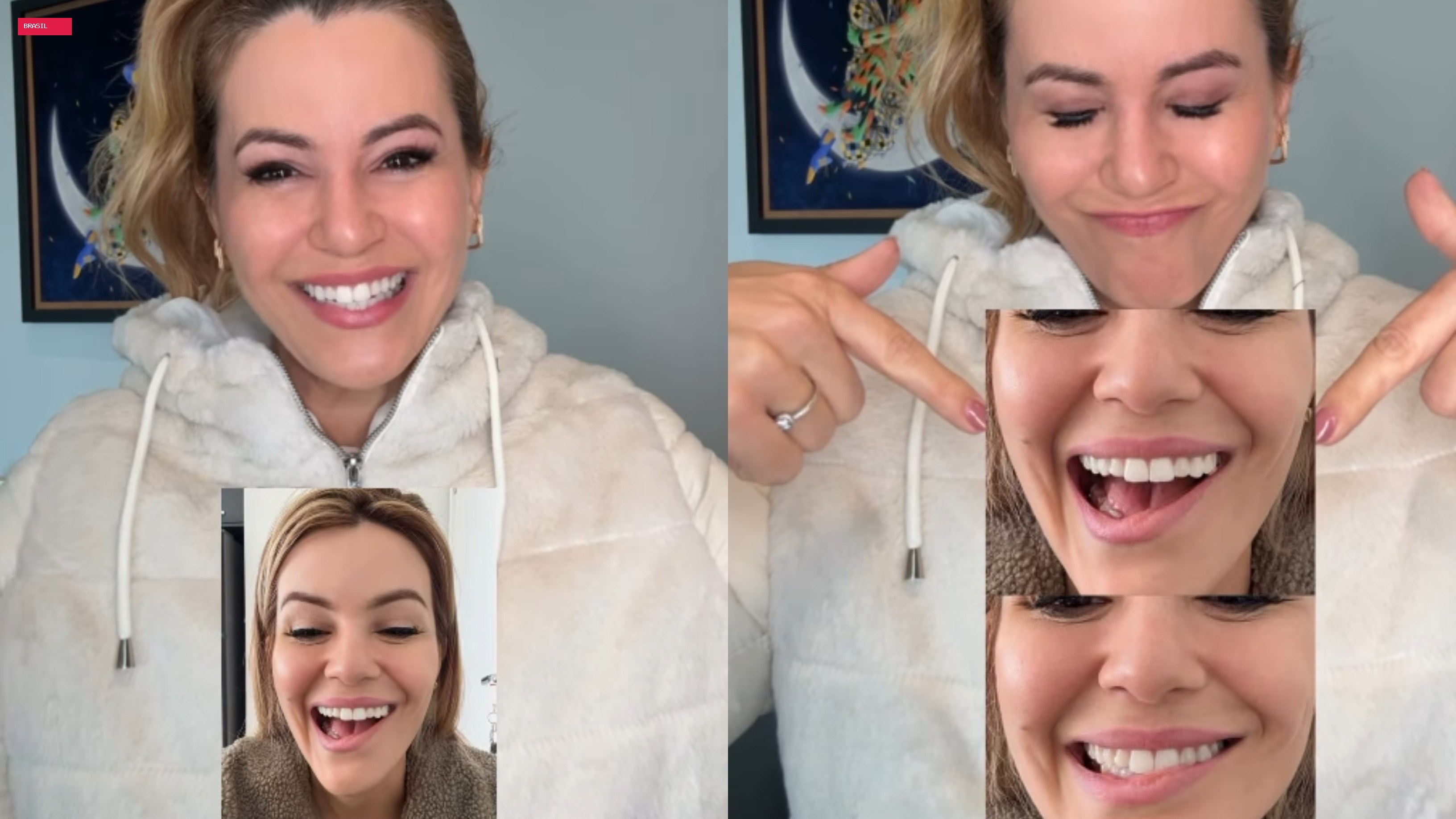 Musa do Carnaval de SP revela que teve nervo facial afetado após retirada de tumor na tireoide