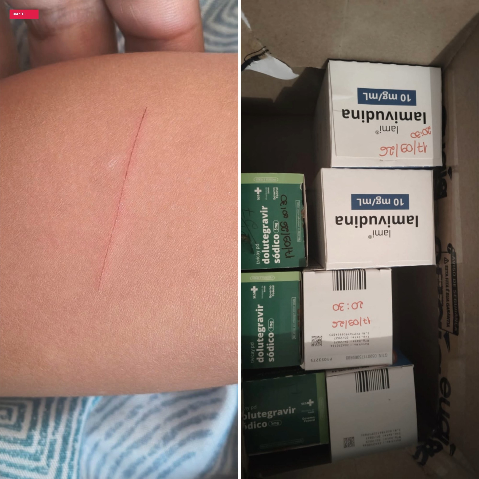 Criança leva navalha para escola e corta colega de 4 anos em Sete Lagoas