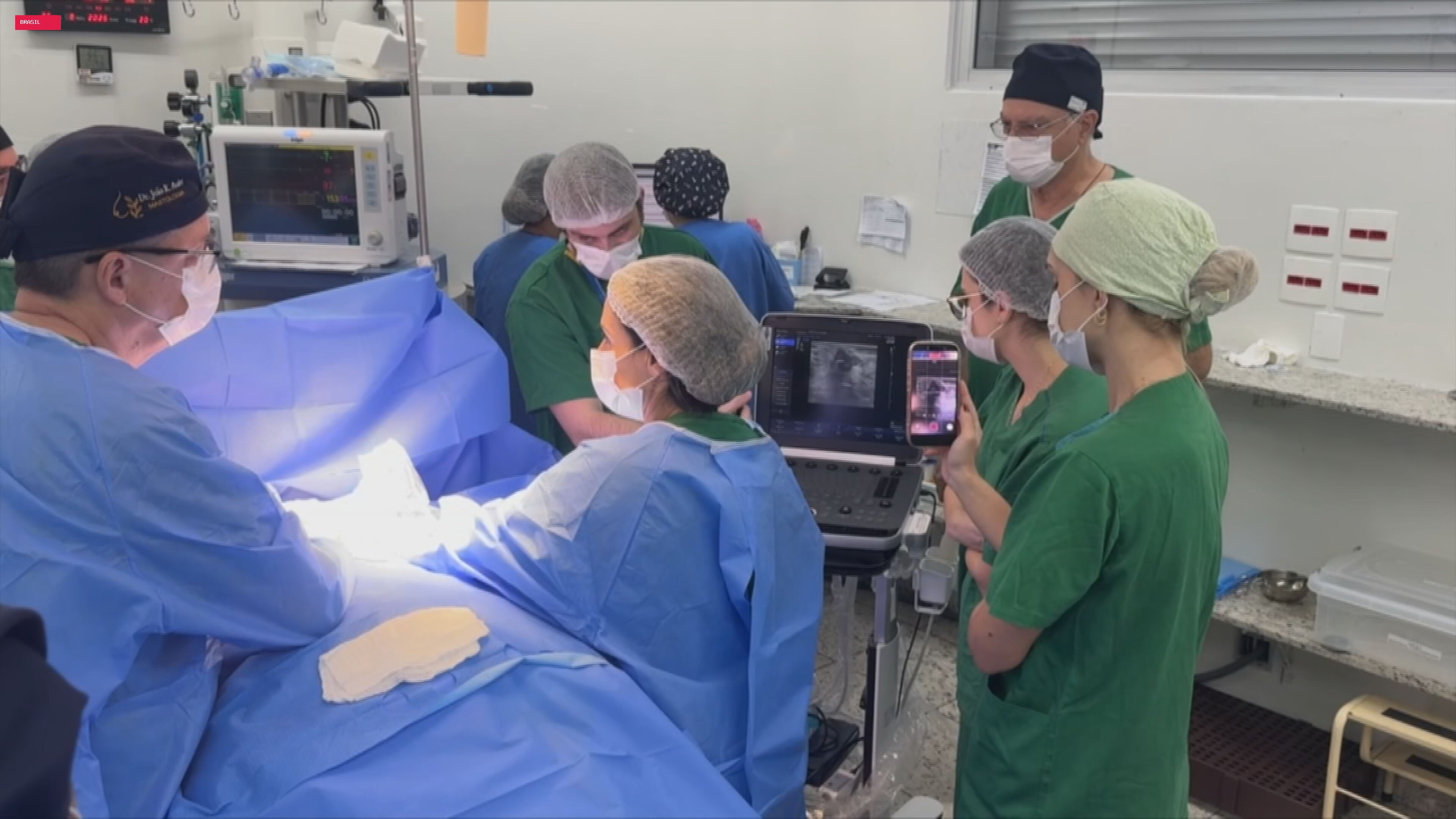 Hospital Amaral Carvalho de Jaú realiza crioablação em paciente com câncer de mama em estudo internacional