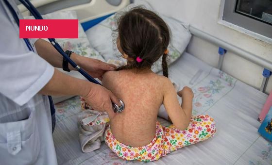 Opas vê risco “muito alto” de propagação do sarampo na América do Sul
