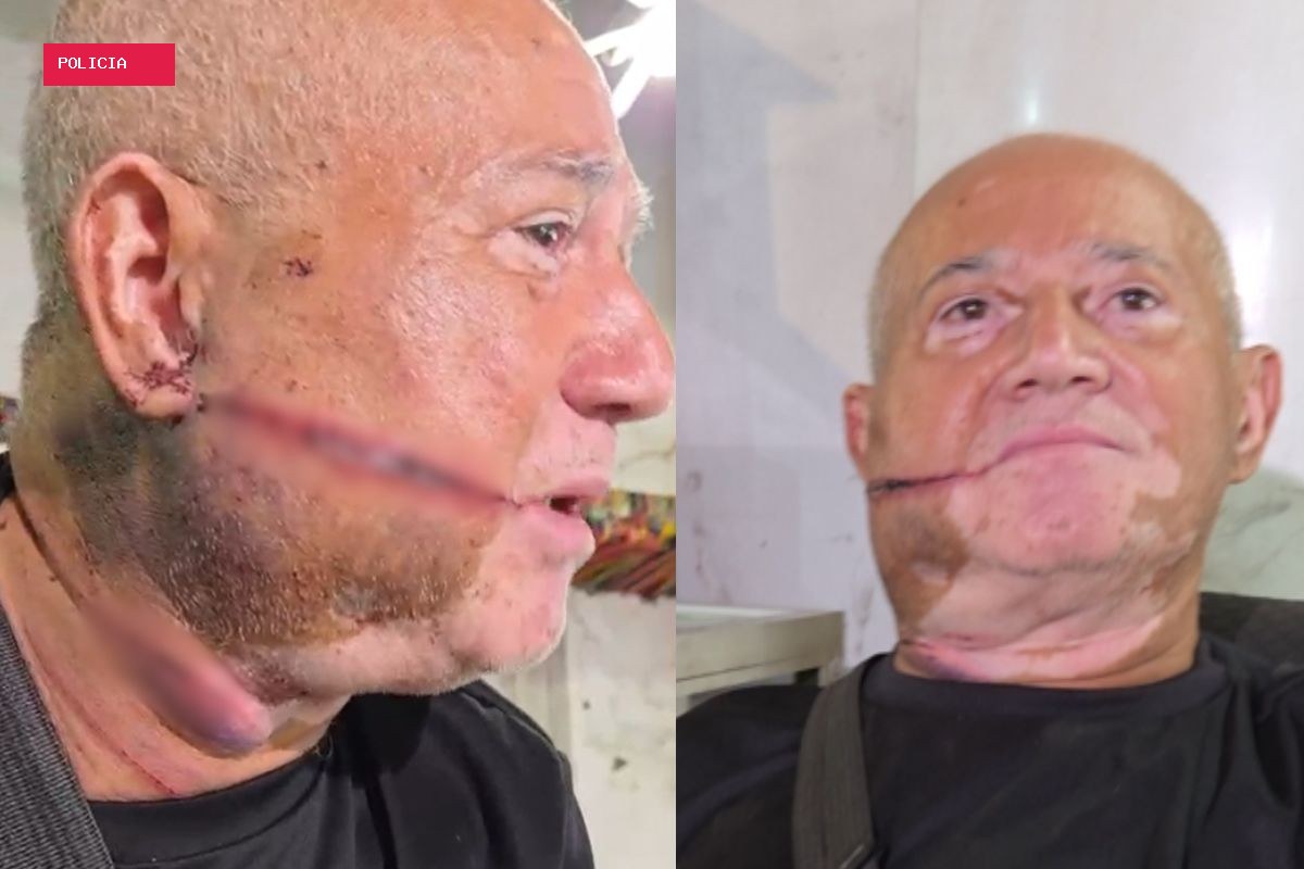 Comerciante acorda com facão no rosto, luta com bandido e tenta salvar a própria vida durante roubo