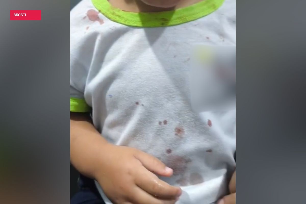 Criança chega à CMEI com ferimentos e camisa com manchas de sangue, e polícia prende padrasto por