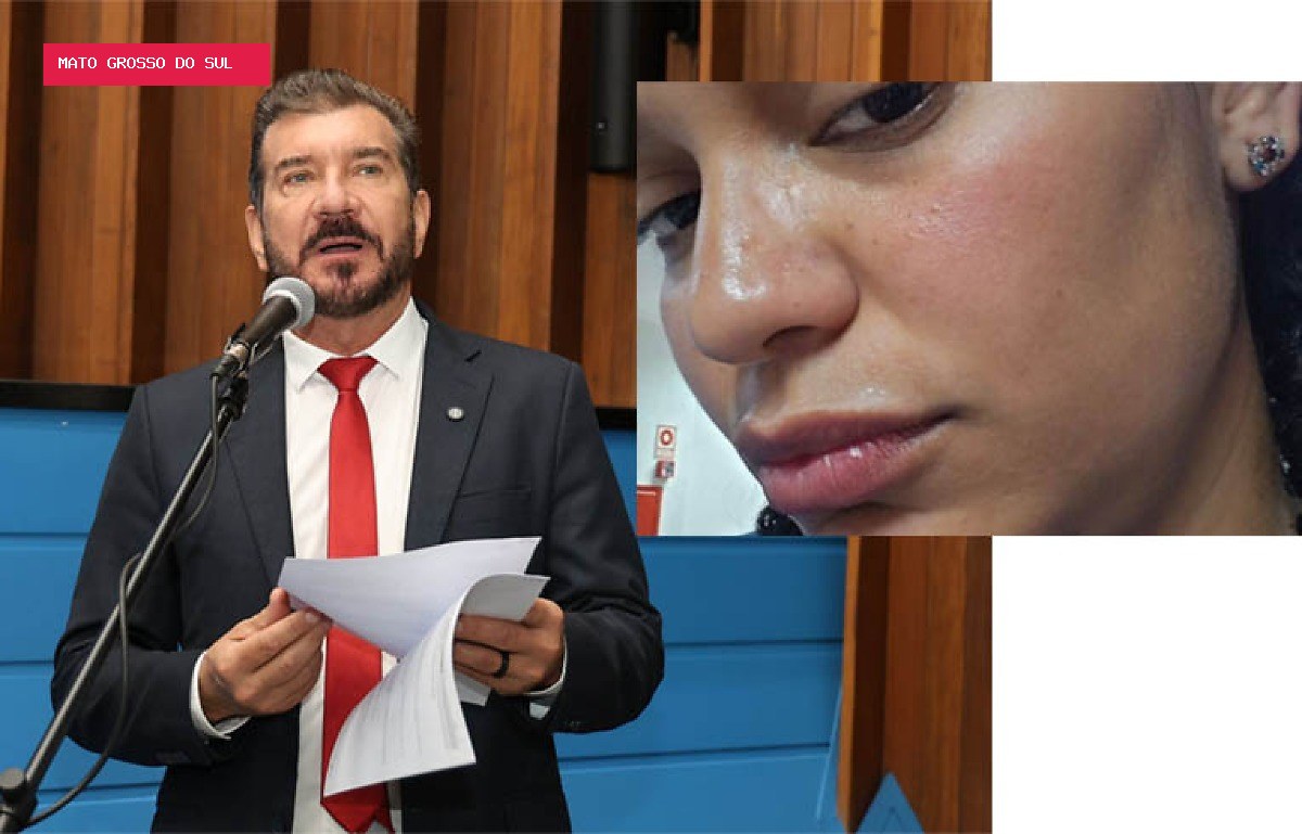 Deputados repudiam agressão a professora durante ato de campanha em Campo Grande